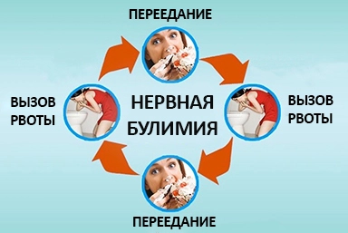 Лечение булимии в городе Сольцы